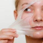 Chemical Peel Treatment Benefits: Reveal Your Radiant Skin